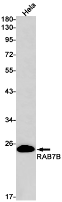 Rab7B Rabbit mAb