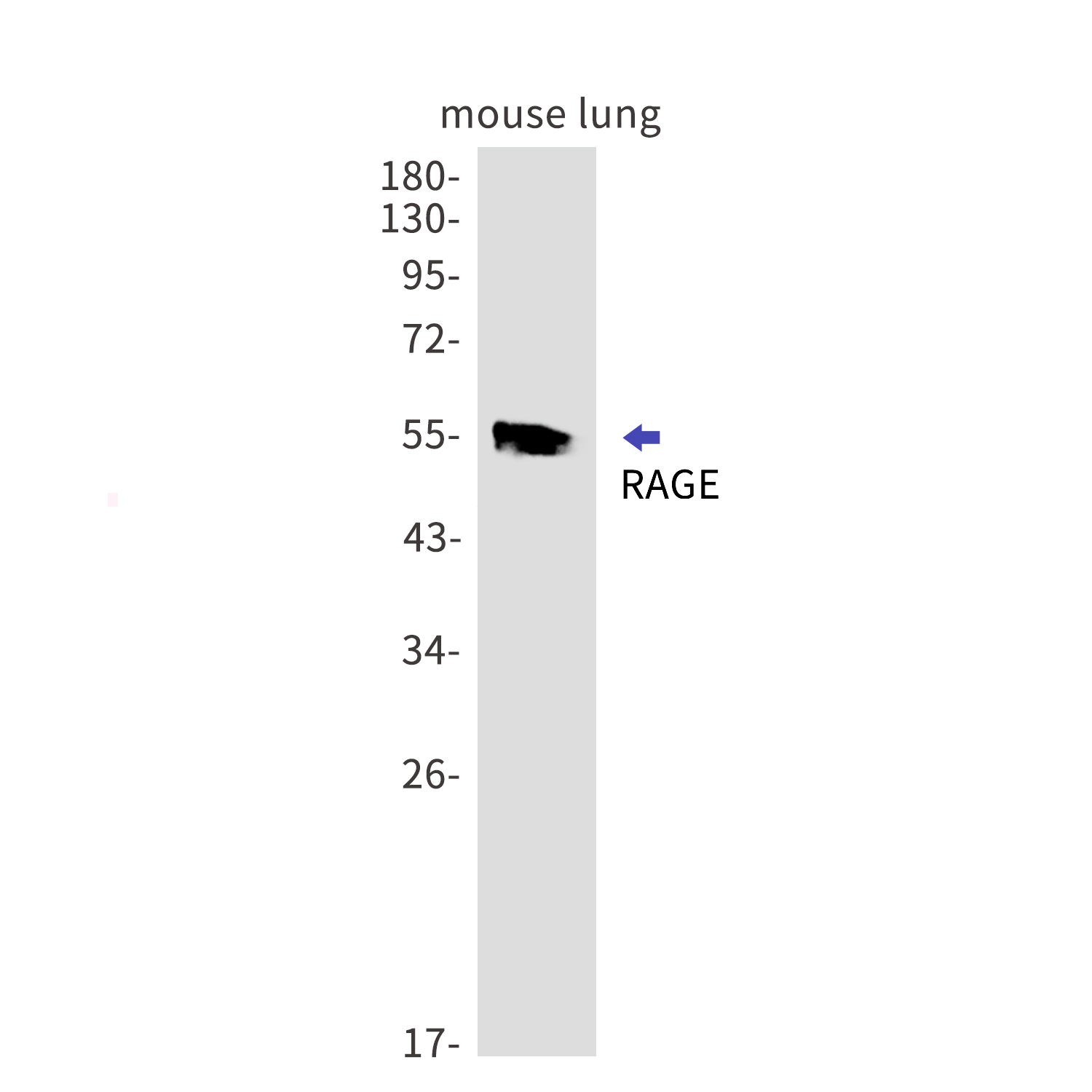 RAGE Rabbit mAb