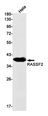 RASSF2 Rabbit mAb