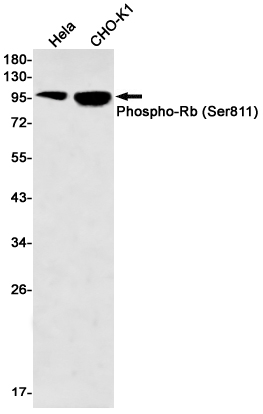 Phospho-Rb (Ser811) Rabbit mAb