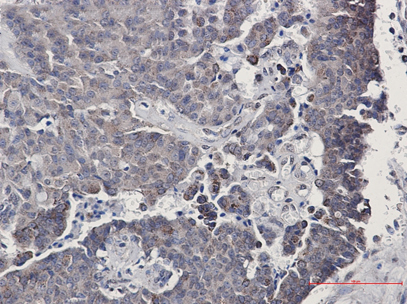 SIRT3 Rabbit mAb