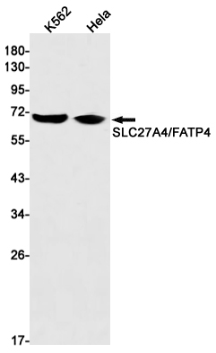 SLC27A4 Rabbit mAb