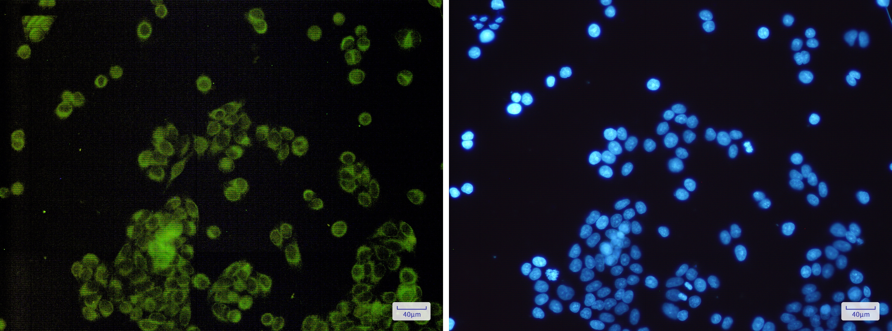 SLC27A4 Rabbit mAb