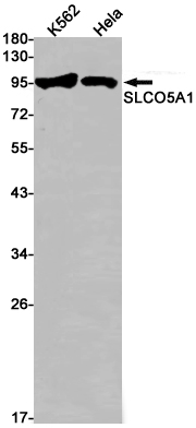 SLCO5A1 Rabbit mAb