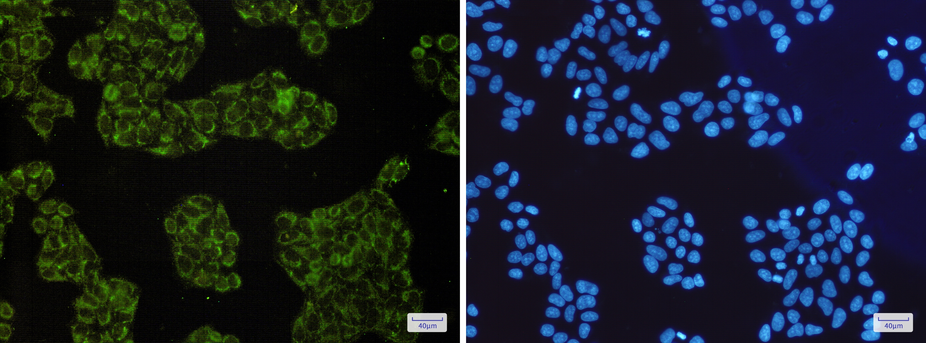 SMAC Rabbit mAb