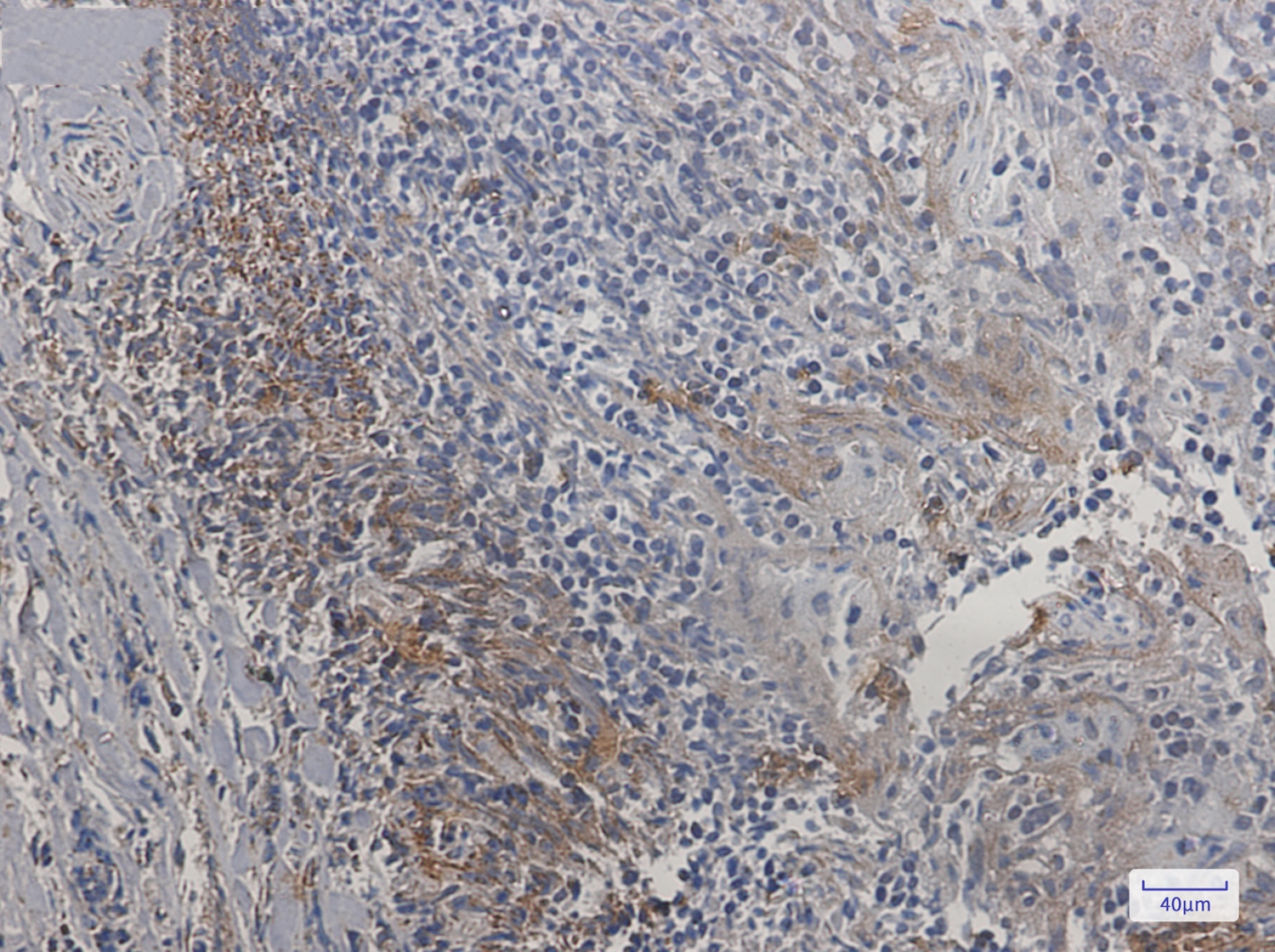 SMAC Rabbit mAb