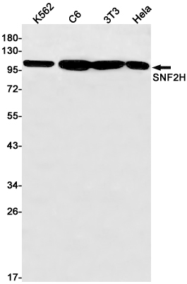 SMARCA5 Rabbit mAb