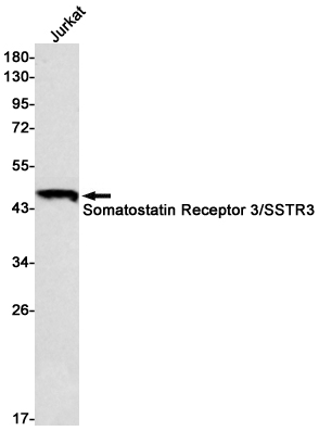 Somatostatin Receptor 3 Rabbit mAb