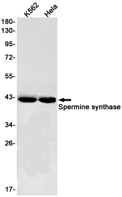 Spermine Synthase Rabbit mAb