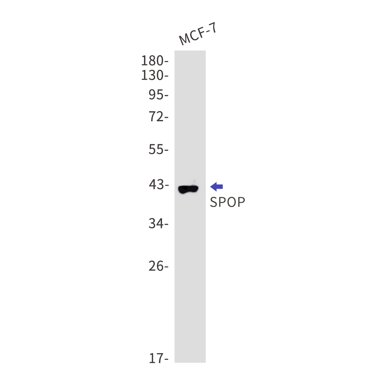 SPOP Rabbit mAb