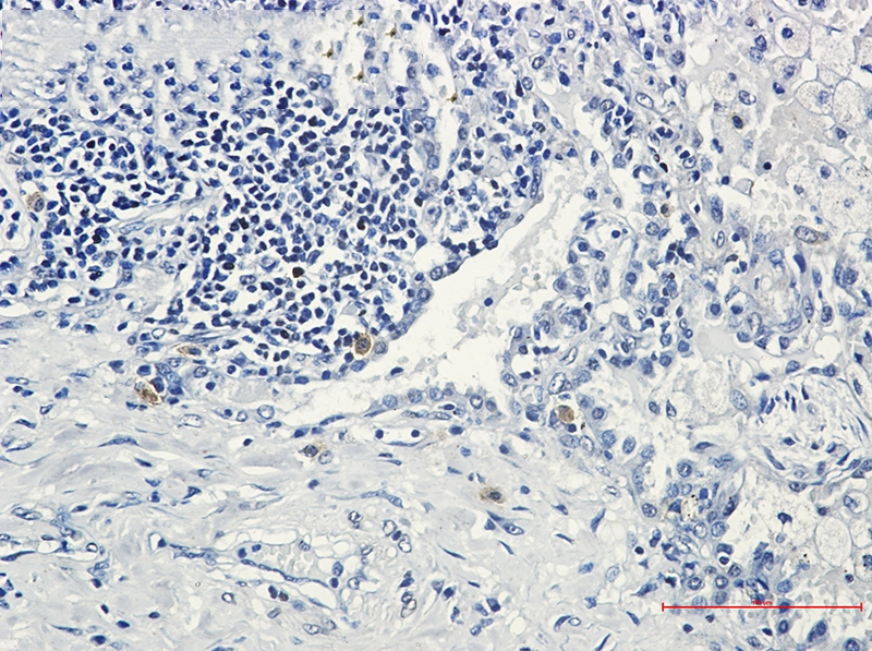 STK3 Rabbit mAb