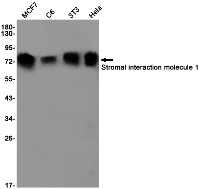 Stromal Interaction Molecule 1 Rabbit mAb