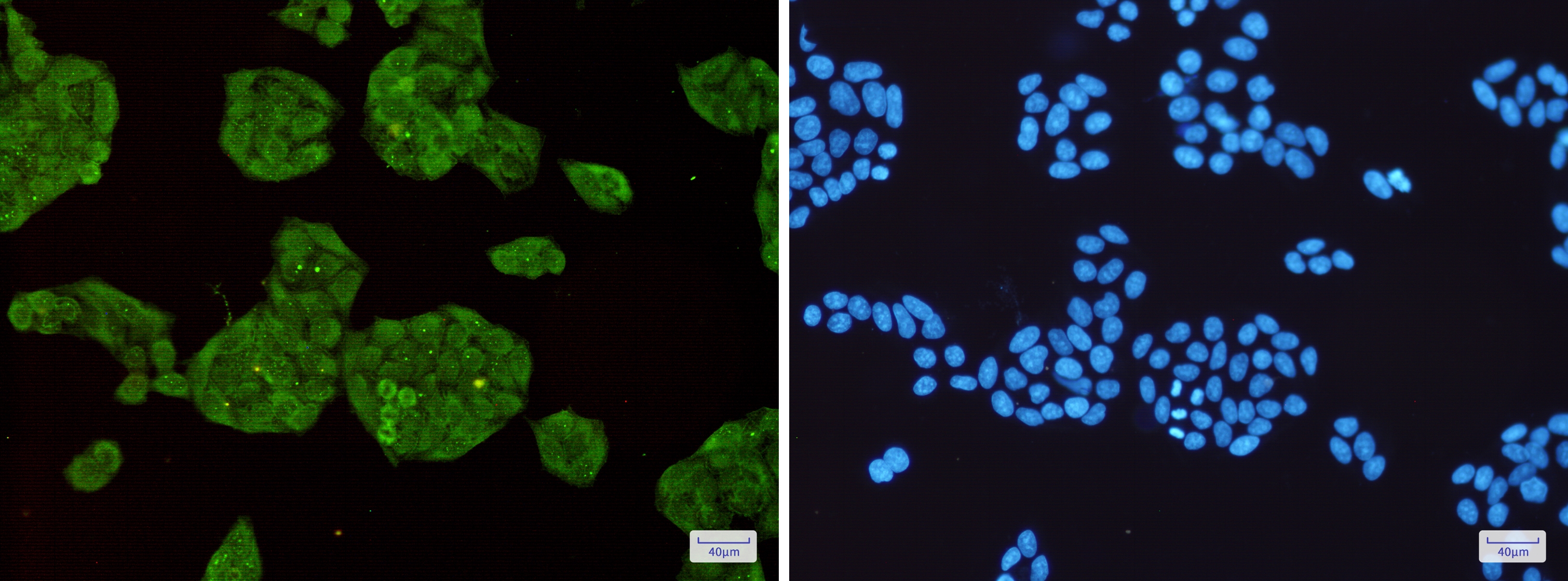 STUB1 Rabbit mAb