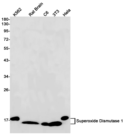 Superoxide Dismutase 1 Rabbit mAb