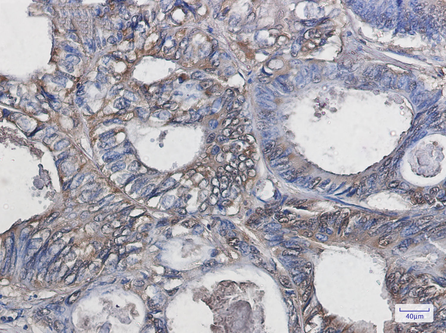 Superoxide Dismutase 1 Rabbit mAb