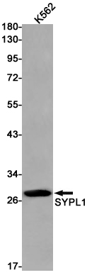 Synaptophysin Like Protein 1 Rabbit mAb