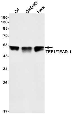 Transcriptional Enhancer Factor TEF 1 Rabbit mAb