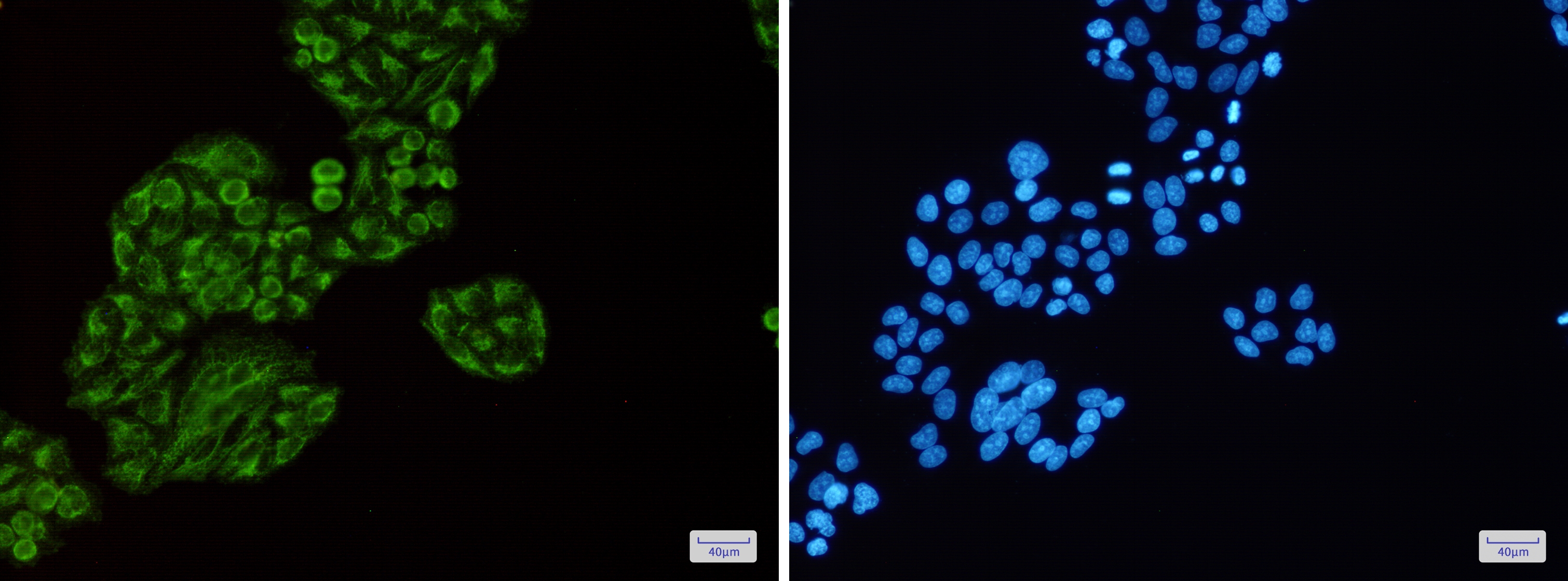 Tec Rabbit mAb