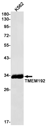 Transmembrane Protein 192 Rabbit mAb