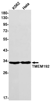 Transmembrane Protein 192 Rabbit mAb