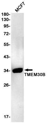 Transmembrane Protein 30B Rabbit mAb