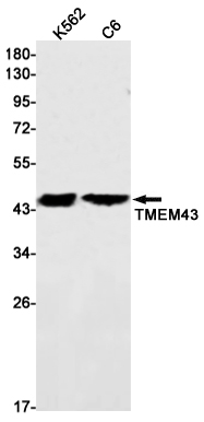 Transmembrane Protein 43 Rabbit mAb