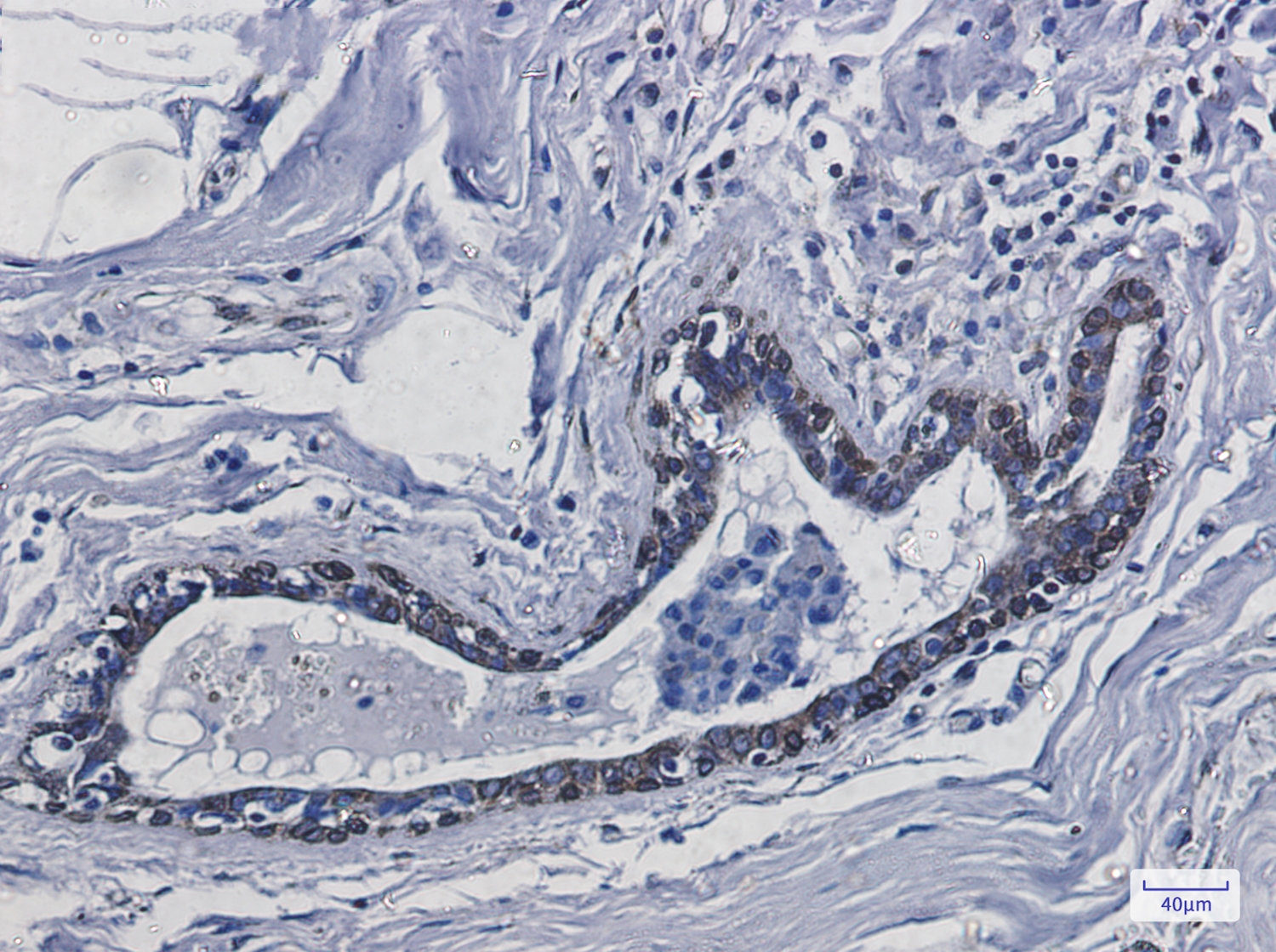 Transmembrane Protein 43 Rabbit mAb