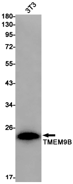 Transmembrane Protein 9B Rabbit mAb