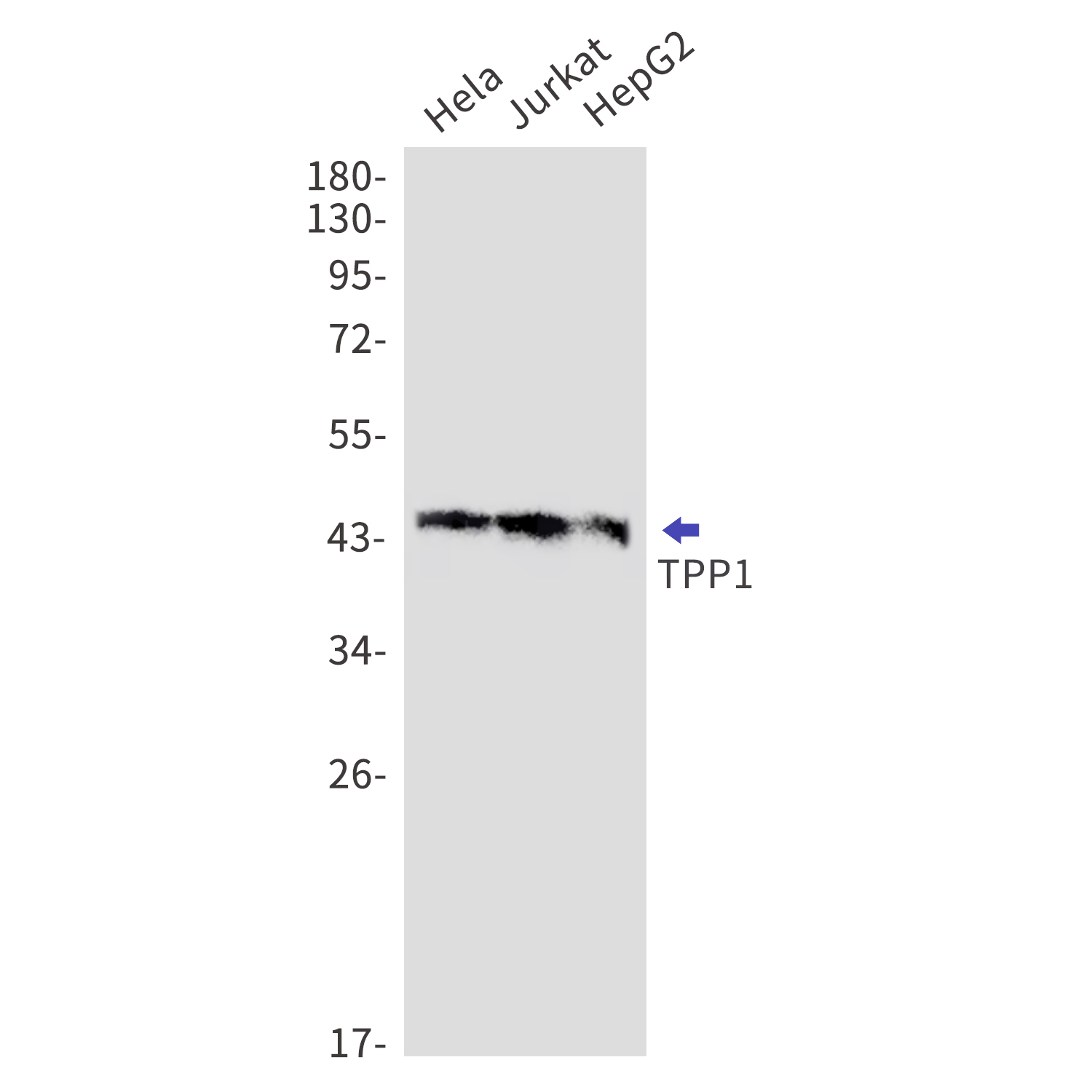 TPP1 Rabbit mAb