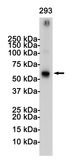 TRAF6 Rabbit mAb