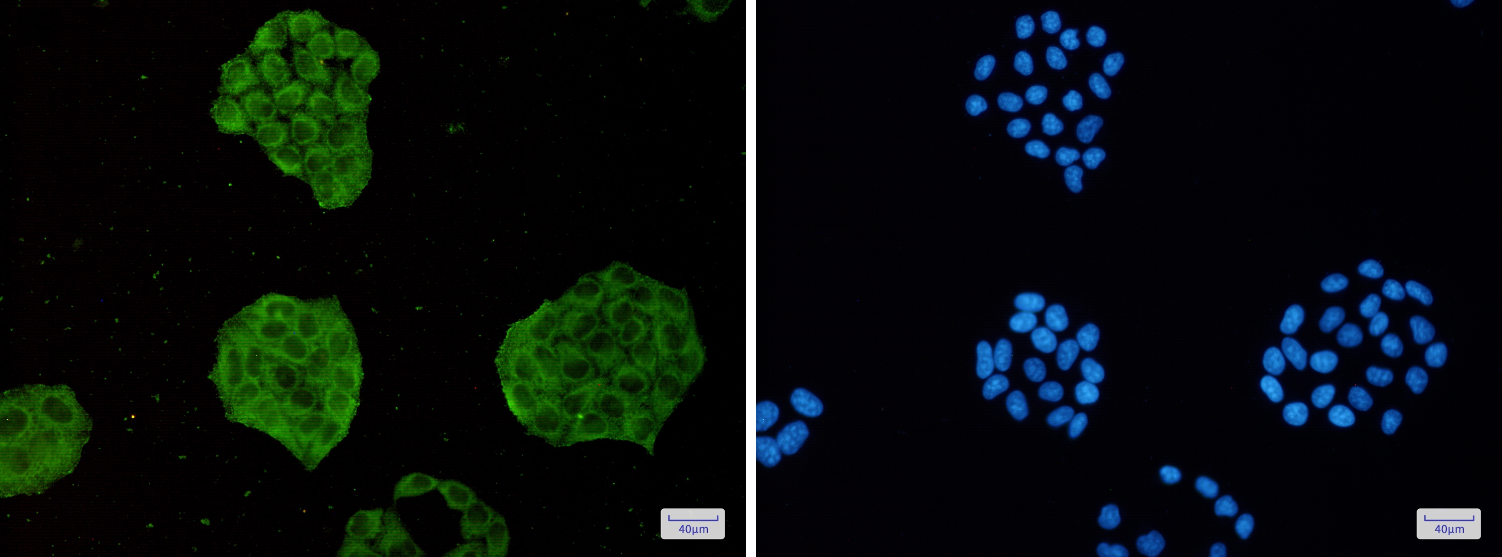 TRIM56 Rabbit mAb