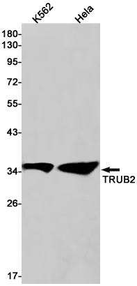 TRUB2 Rabbit mAb