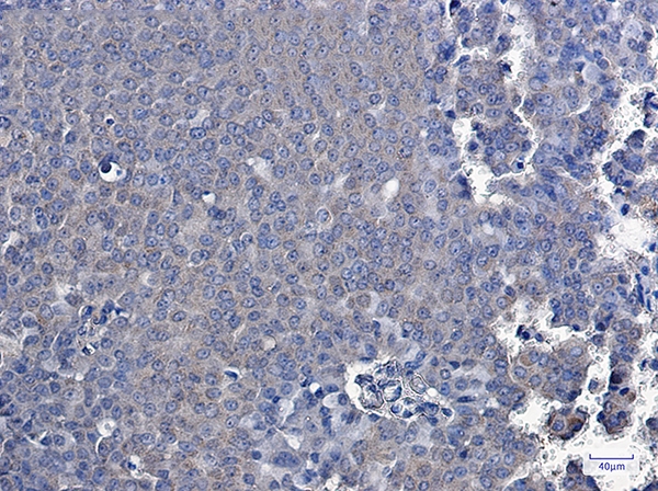 TXNDC9 Rabbit mAb