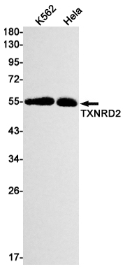 Thioredoxin Reductase 2 Rabbit mAb