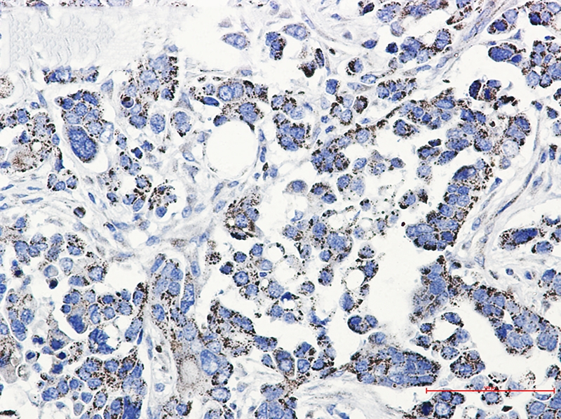 Thioredoxin Reductase 2 Rabbit mAb