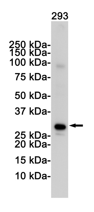 VDAC1 Rabbit mAb