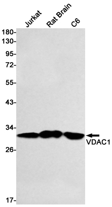 VDAC1 Rabbit mAb