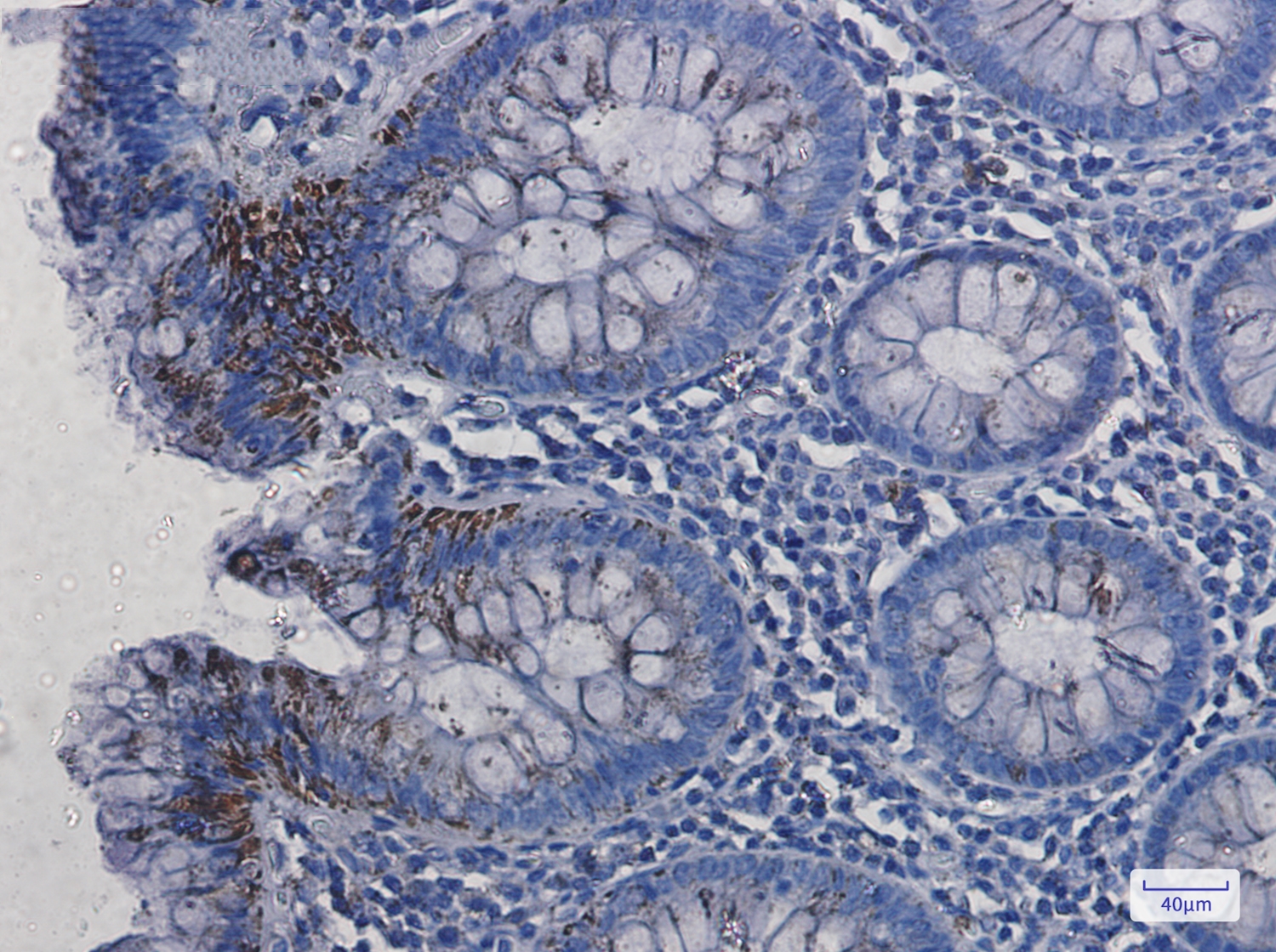 VDAC1 Rabbit mAb