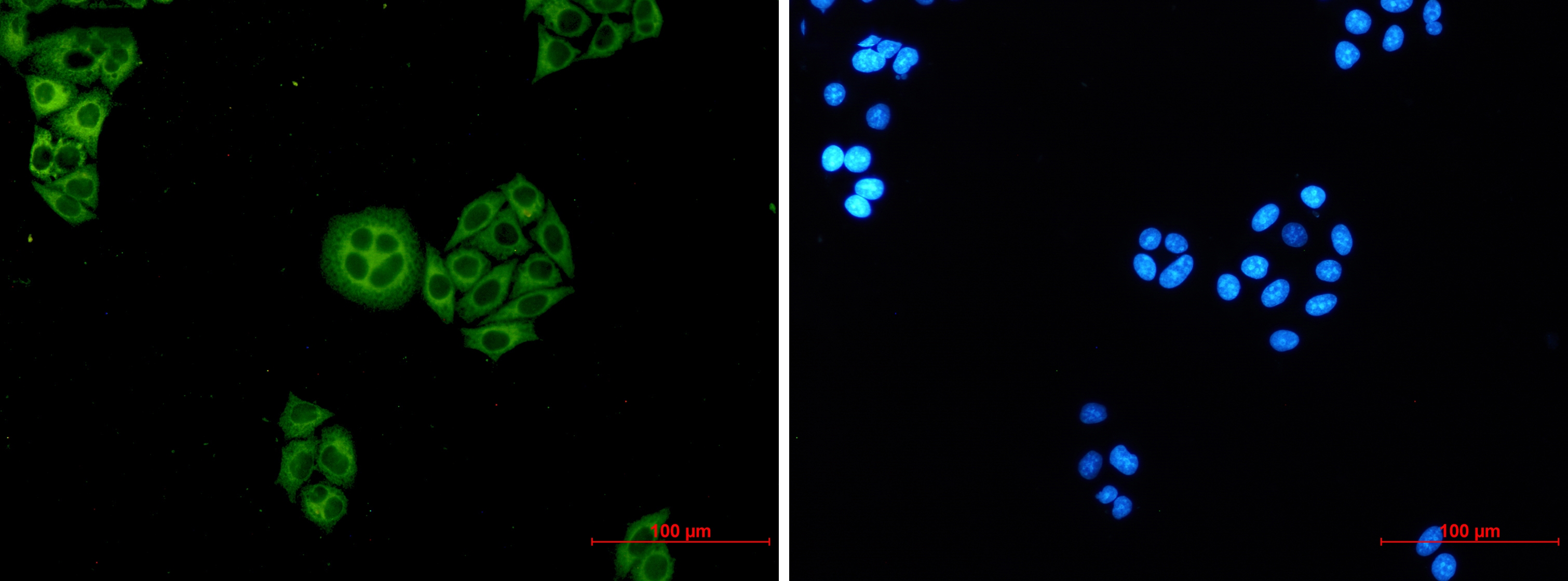 WDR1 Rabbit mAb