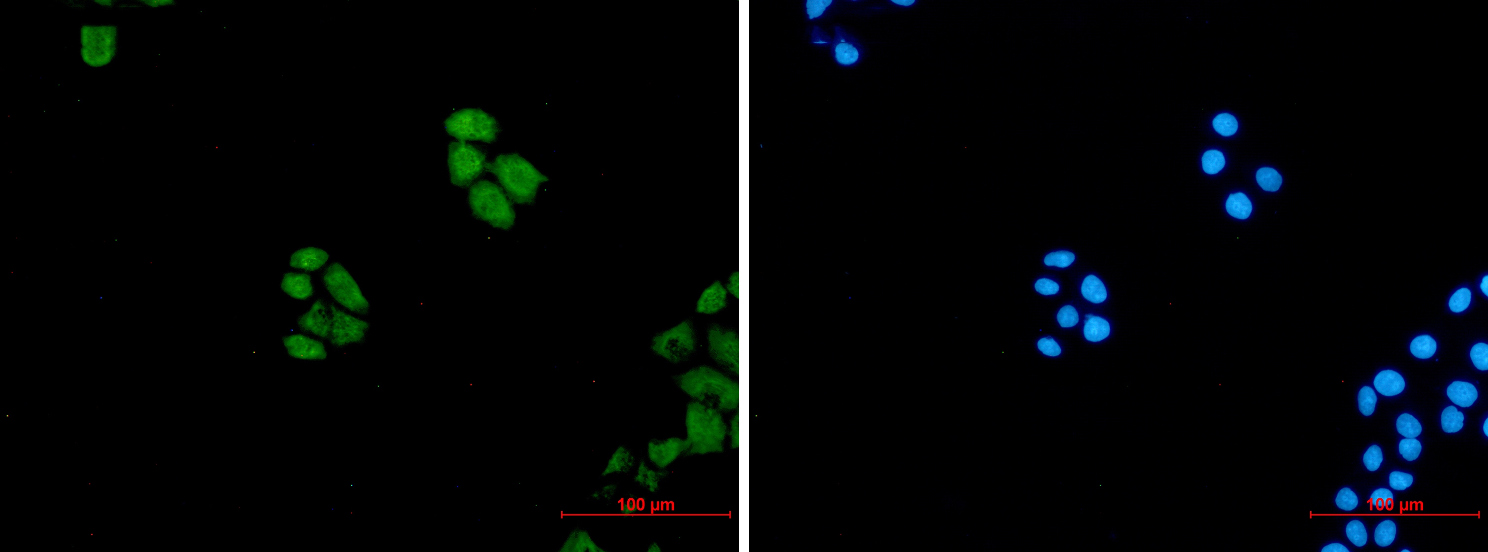 Wnt5a Rabbit mAb