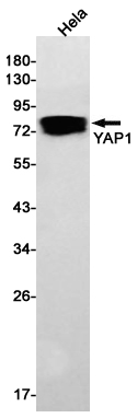 YAP1 Rabbit mAb