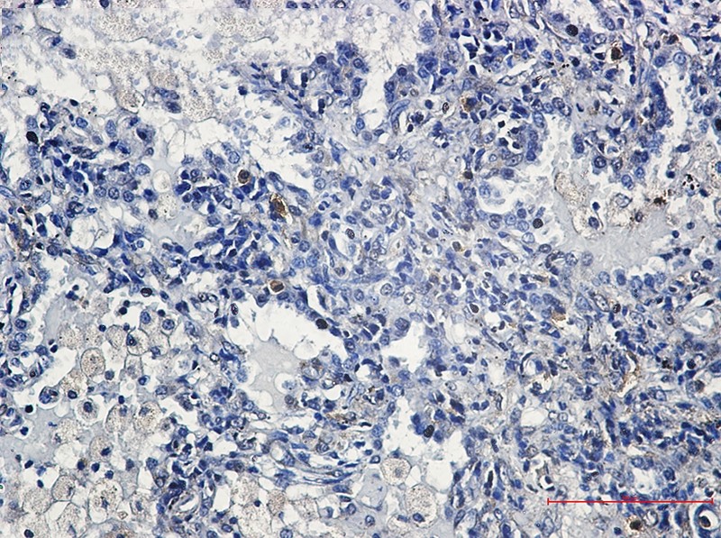 YB1 Rabbit mAb