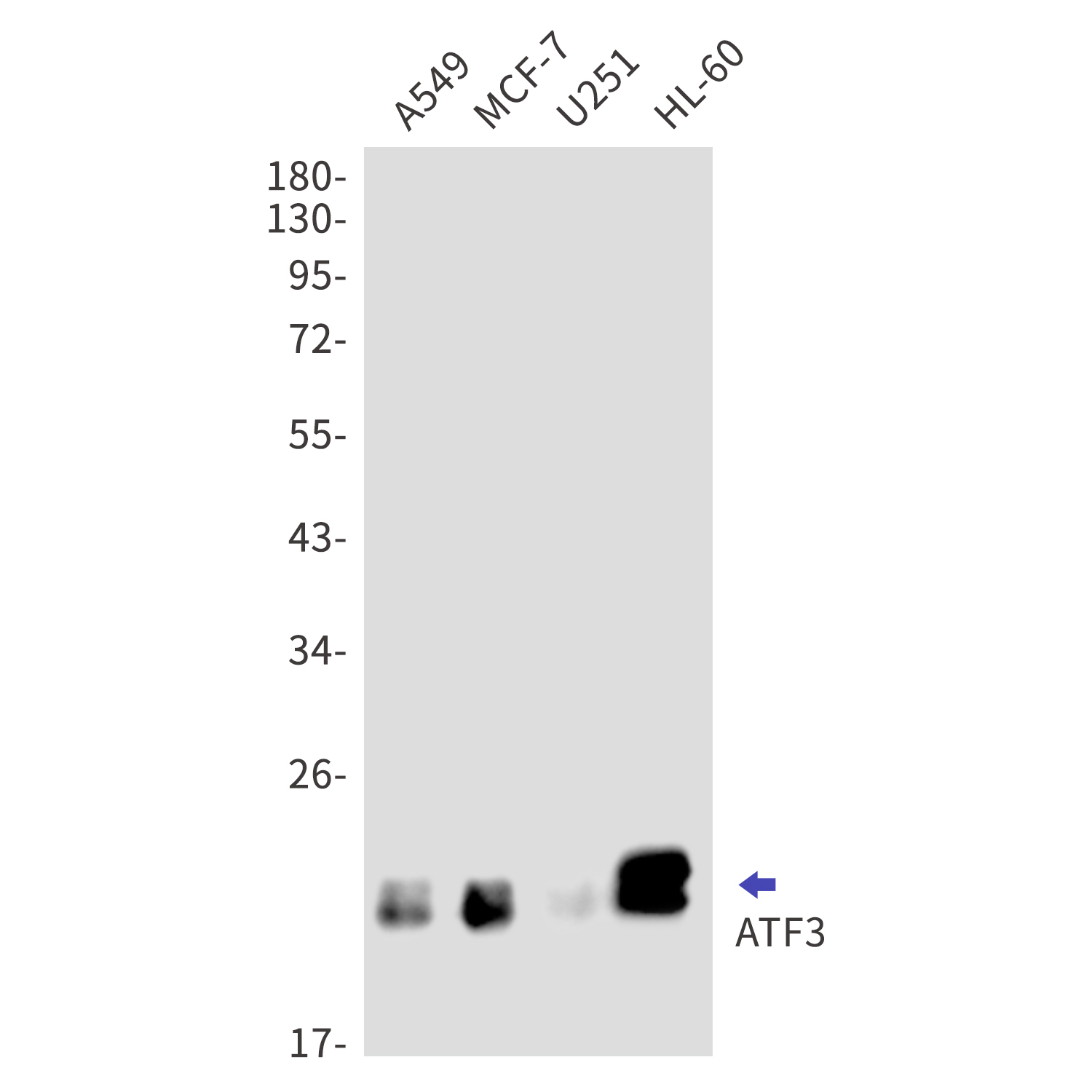 ATF3 Rabbit mAb