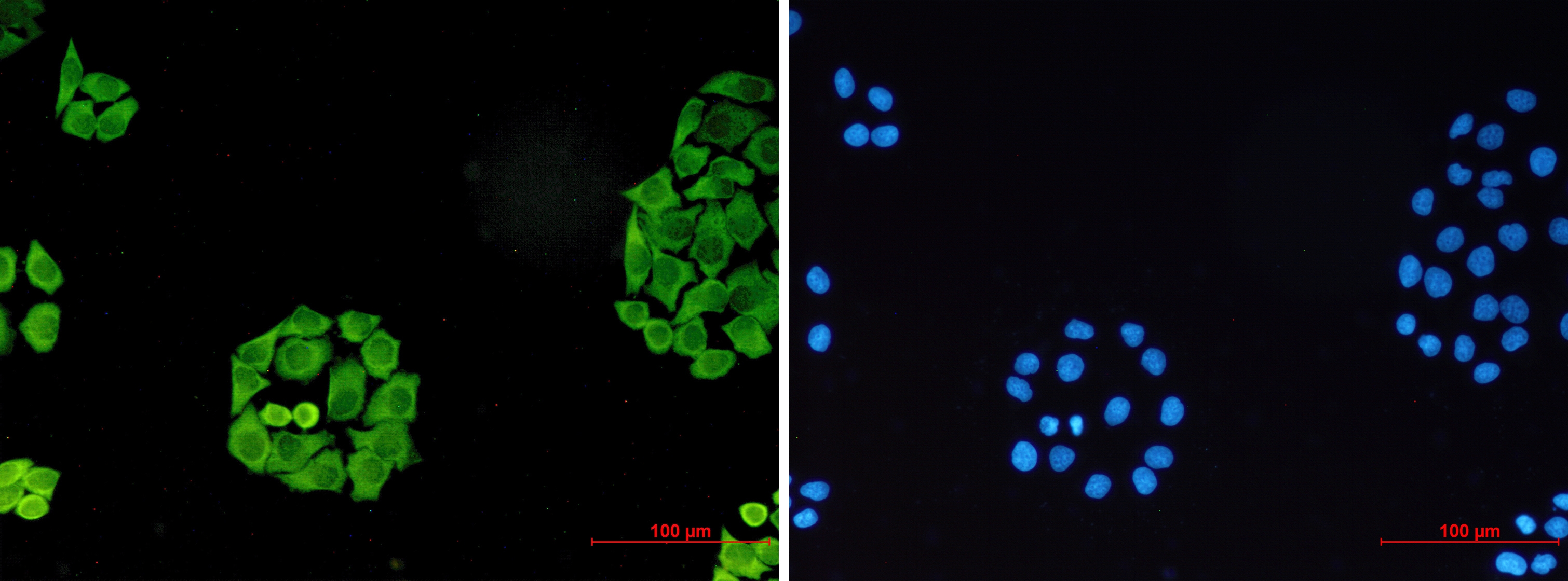 Surfeit Locus Protein 4 Rabbit mAb