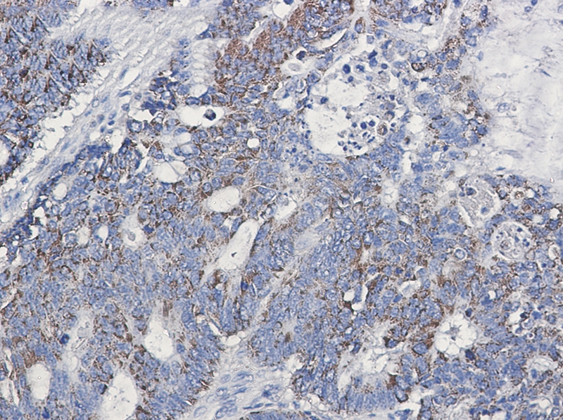 CD147 Rabbit mAb