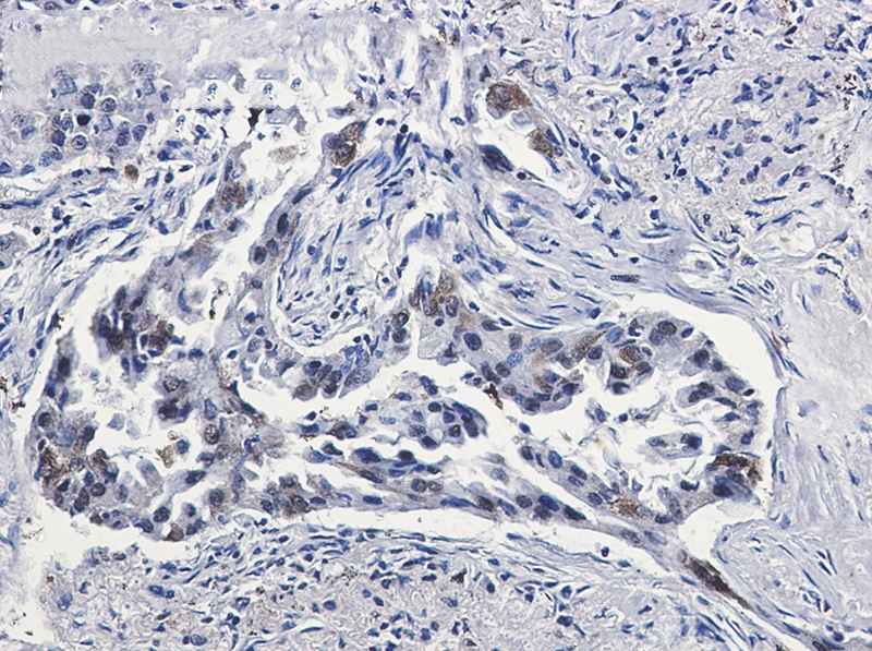 Tissue Factor Rabbit mAb