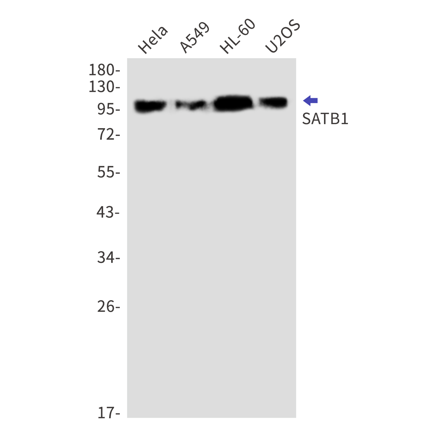 SATB1 Rabbit mAb