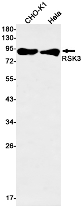 RSK3 Rabbit mAb