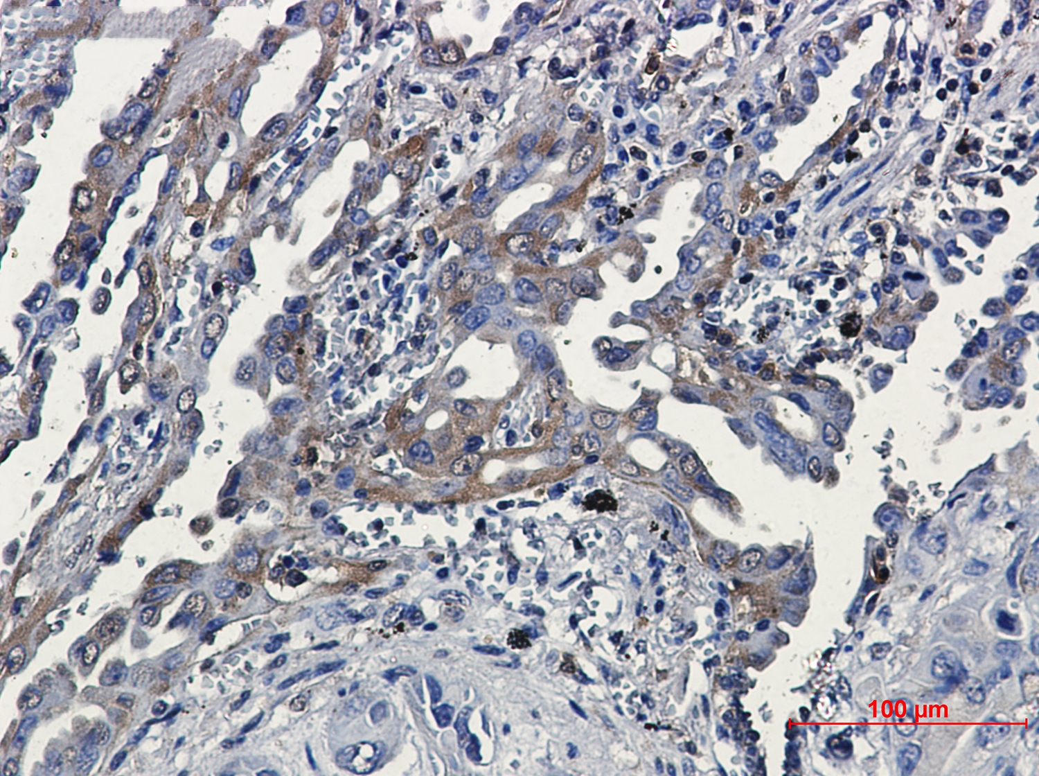 RSK3 Rabbit mAb