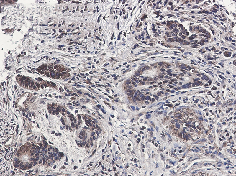 MST1 Rabbit mAb